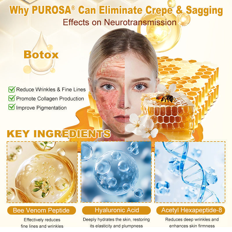 𝑷𝑼𝑹𝑶𝑺𝑨® 𝘽𝙀𝙀 𝙑𝙀𝙉𝙊𝙈 𝙎𝙠𝙞𝙣 𝙍𝙚𝙨𝙩𝙤𝙧𝙖𝙩𝙞𝙤𝙣 𝘾𝙧𝙚𝙖𝙢 –🍀 Anti-aging,Hydrating, Skin Repair, Even Tone, Acne and Dark Spot Treatment, Wart and Mole Removal, Psoriasis Relief