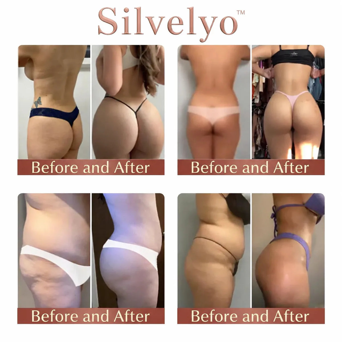 Silvelyo™ CurveSculpt Micro-Patch – Your At-Home Butt Lift Secret 🍑