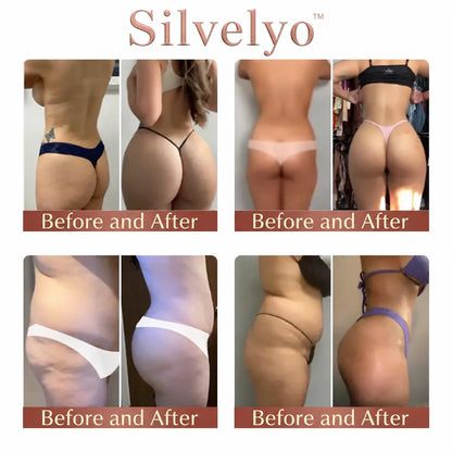 Silvelyo™ CurveSculpt Micro-Patch – Your At-Home Butt Lift Secret 🍑