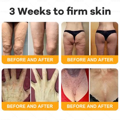 𝑷𝑼𝑹𝑶𝑺𝑨® 𝘽𝙀𝙀 𝙑𝙀𝙉𝙊𝙈 𝙎𝙠𝙞𝙣 𝙍𝙚𝙨𝙩𝙤𝙧𝙖𝙩𝙞𝙤𝙣 𝘾𝙧𝙚𝙖𝙢 –🍀 Anti-aging,Hydrating, Skin Repair, Even Tone, Acne and Dark Spot Treatment, Wart and Mole Removal, Psoriasis Relief
