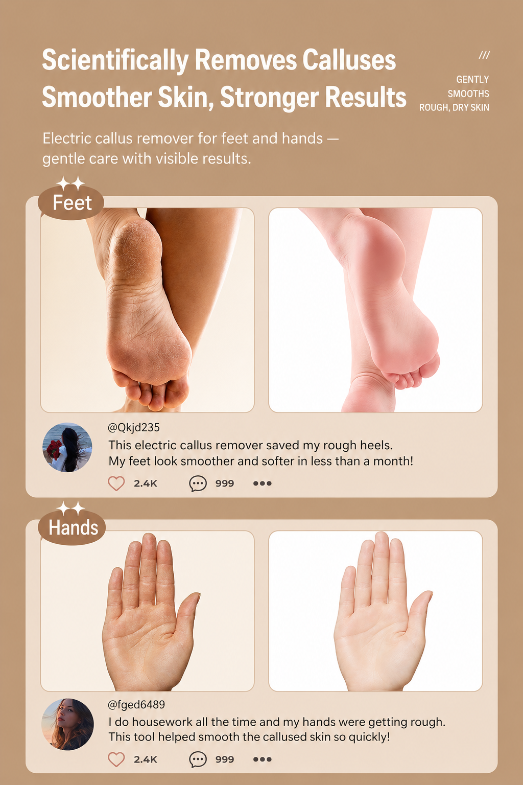 🔋LIMITED-TIME 50% OFF! Dead Skin & Callus Remover Pro™ – Effortlessly Remove Tough Calluses, Dead Skin & Rough Areas for Silky Smooth Hands & Feet