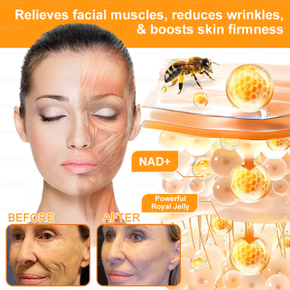 𝑷𝑼𝑹𝑶𝑺𝑨® 𝘽𝙀𝙀 𝙑𝙀𝙉𝙊𝙈 𝙎𝙠𝙞𝙣 𝙍𝙚𝙨𝙩𝙤𝙧𝙖𝙩𝙞𝙤𝙣 𝘾𝙧𝙚𝙖𝙢 –🍀 Anti-aging,Hydrating, Skin Repair, Even Tone, Acne and Dark Spot Treatment, Wart and Mole Removal, Psoriasis Relief